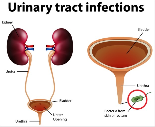 UTI and Bladder