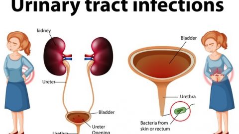 How long does a UTI last