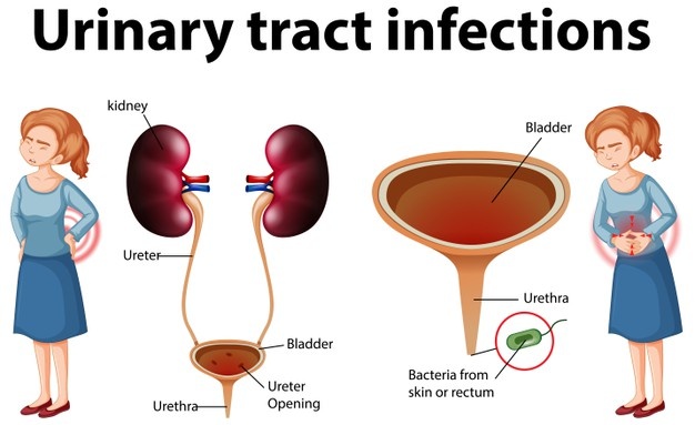 How long does a UTI last